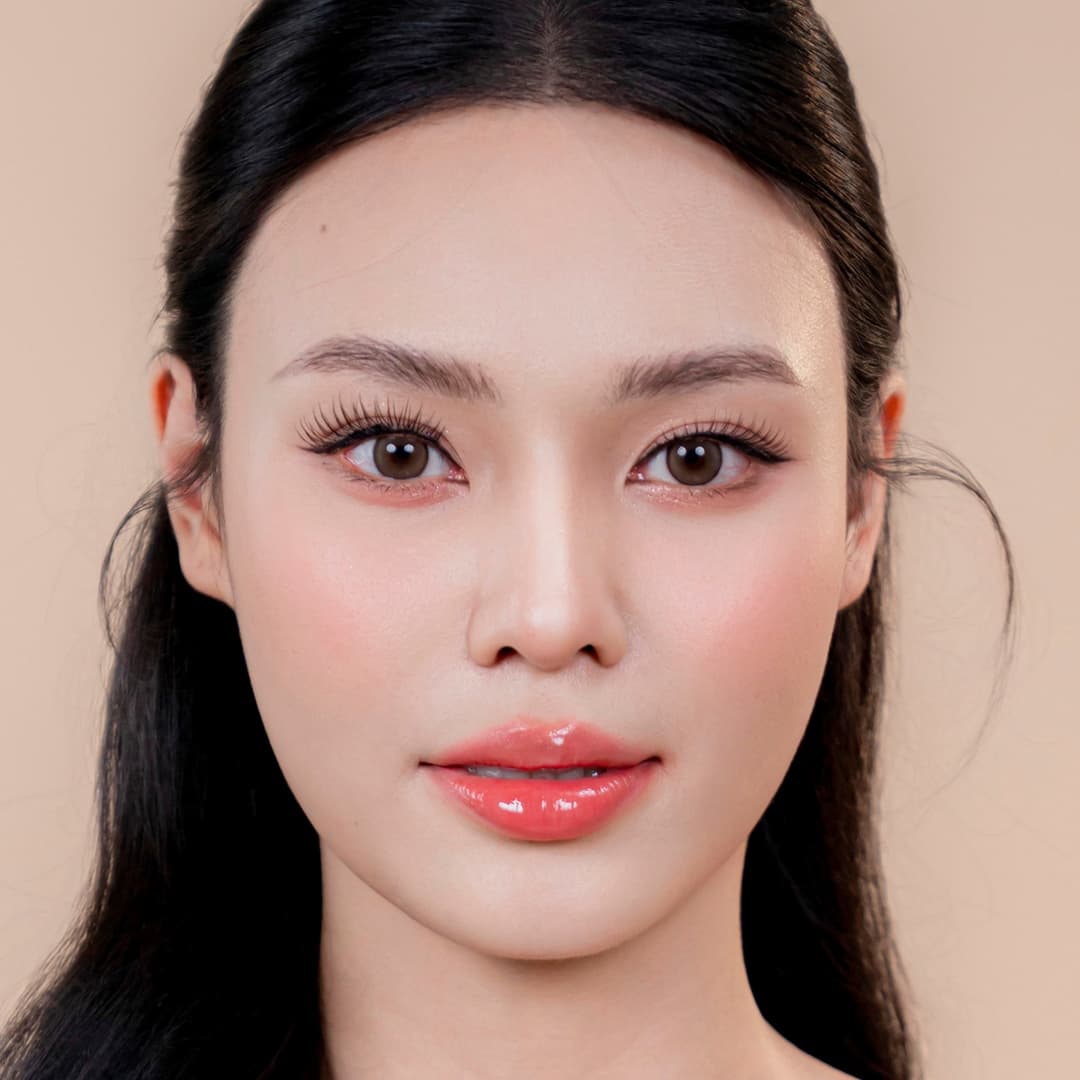 Patient Luu Phuong Anh - After One Fit rhinoplasty (close-up)