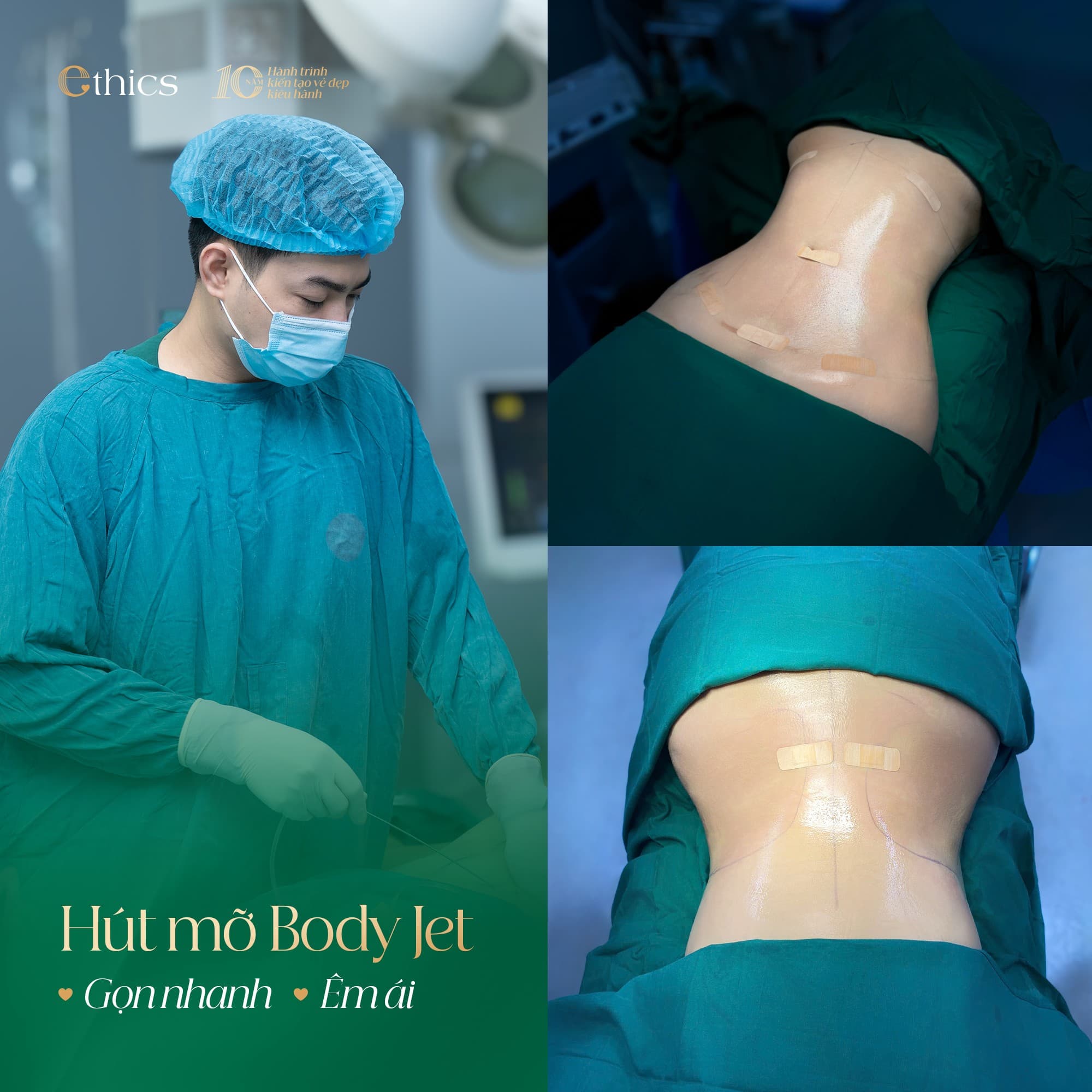 Slim Fit Liposuction