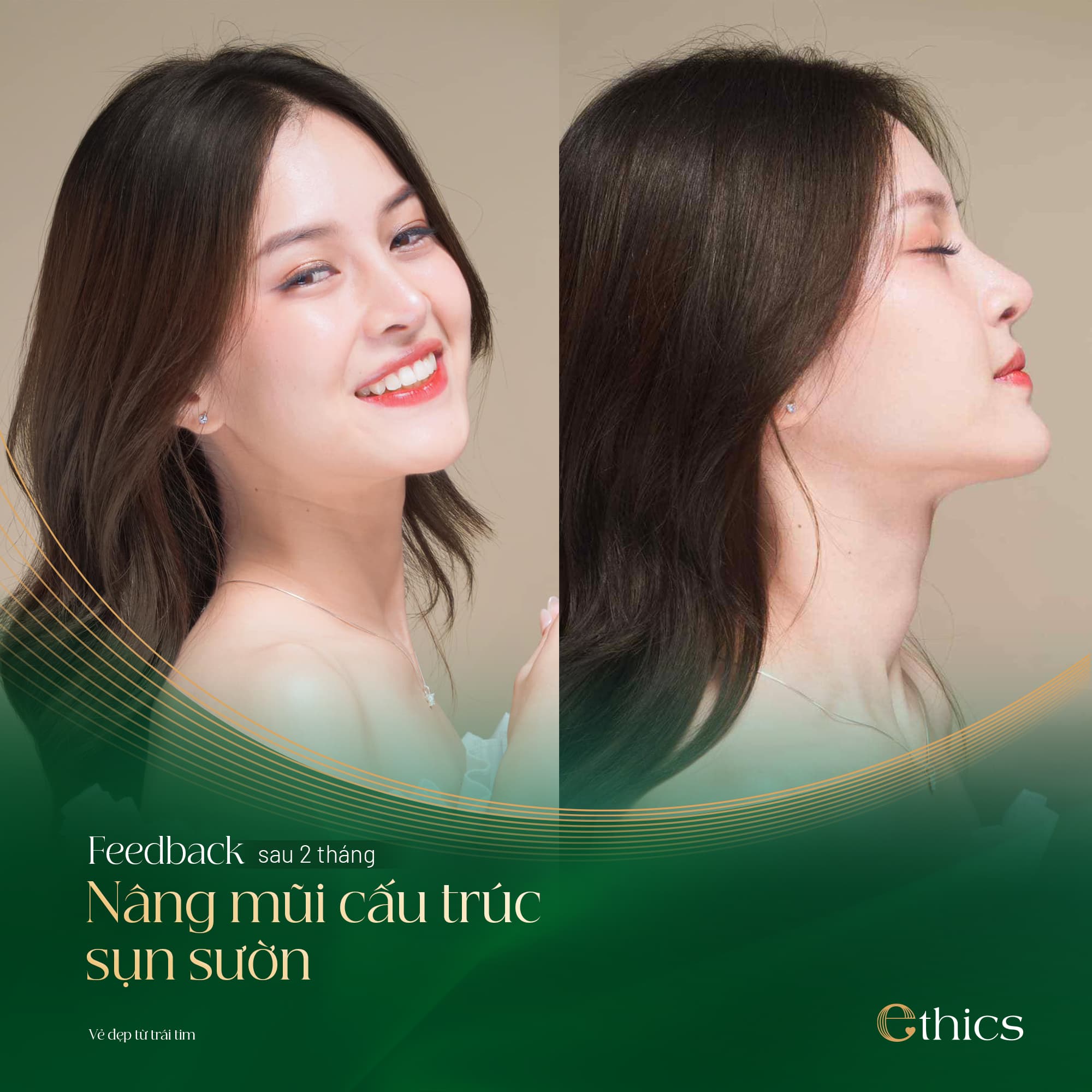 Structural Rhinoplasty