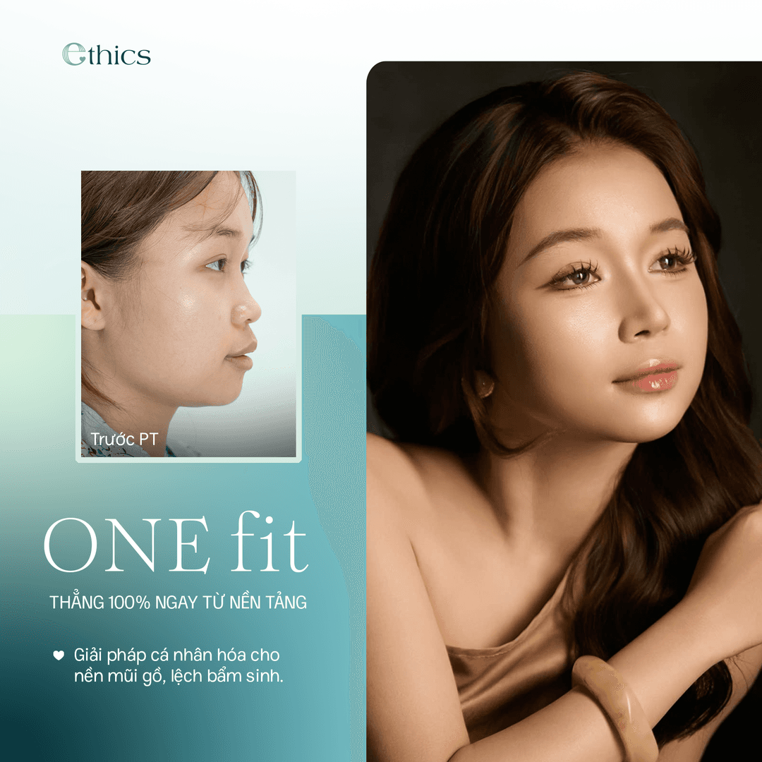 OneFit chin augmentation using Ethics' exclusive 3D-printed cartilage technology